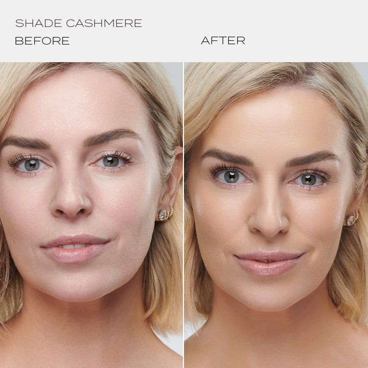 Skintuition Foundation