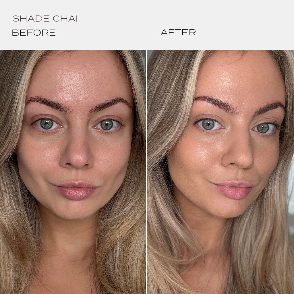 Skintuition Foundation