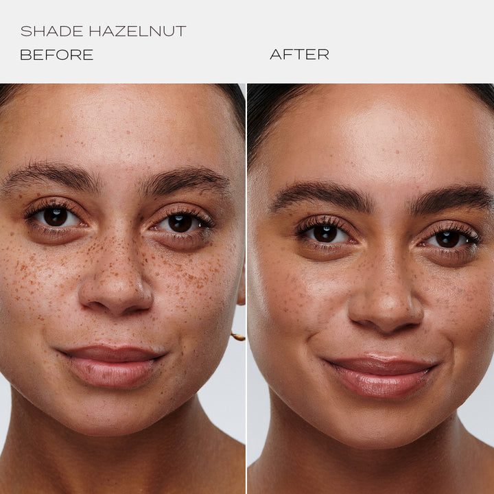 Skintuition Foundation