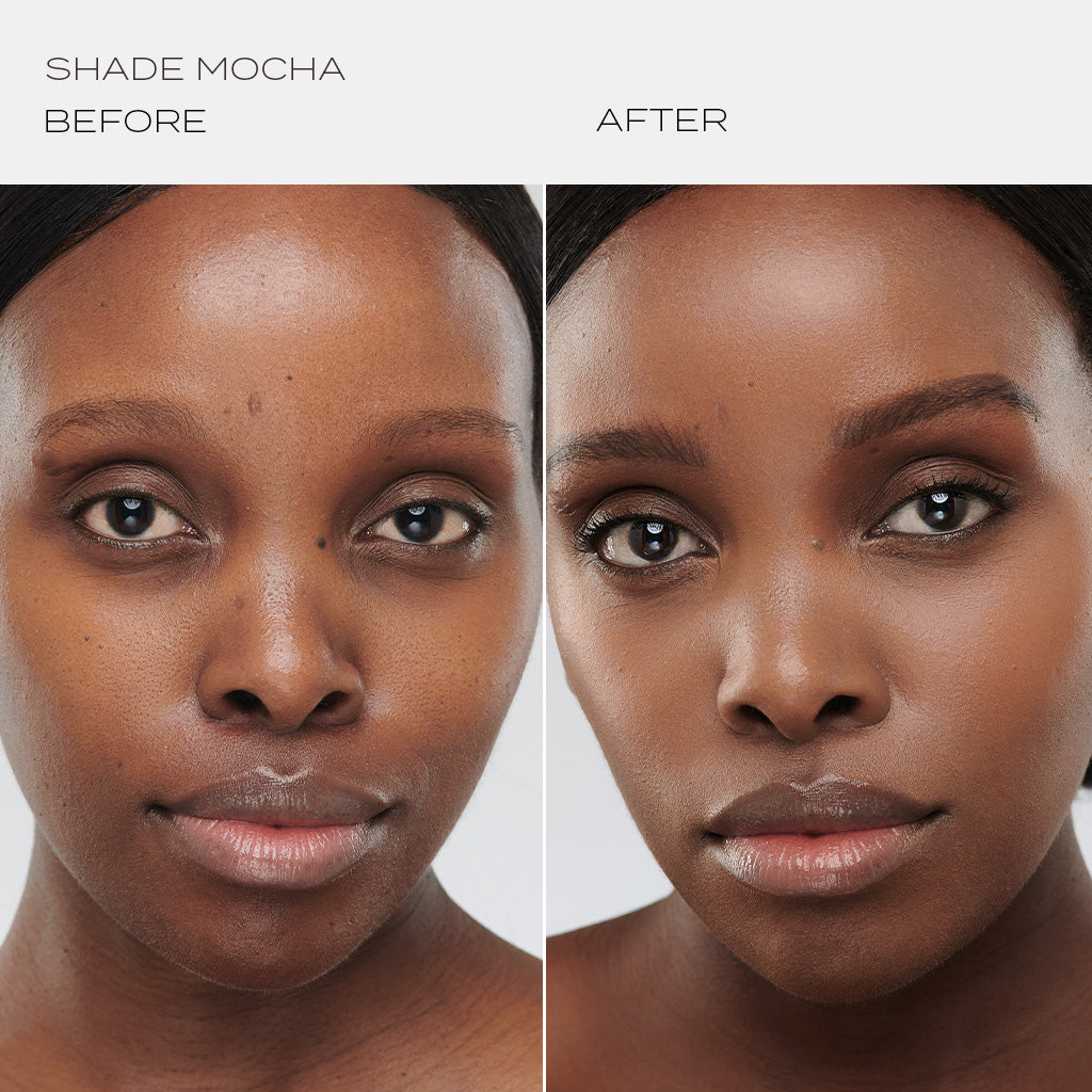 Skintuition Foundation