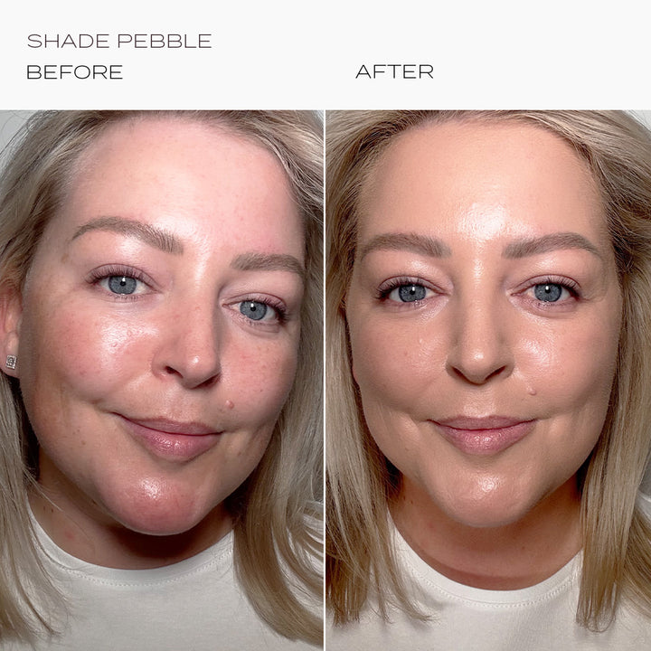 Skintuition Foundation