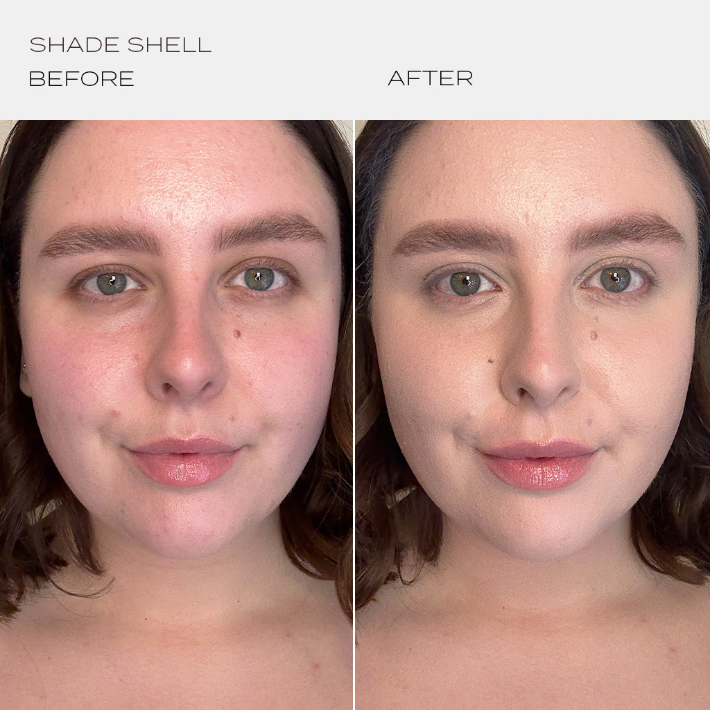 Skintuition Foundation