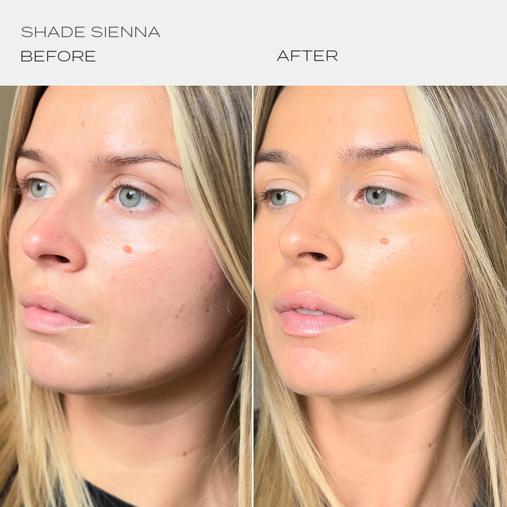 Skintuition Foundation