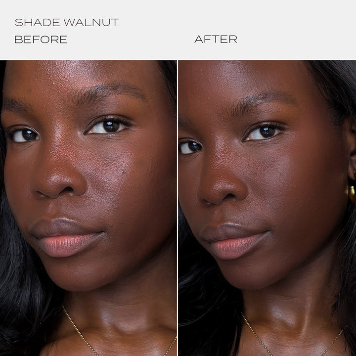 Skintuition Foundation