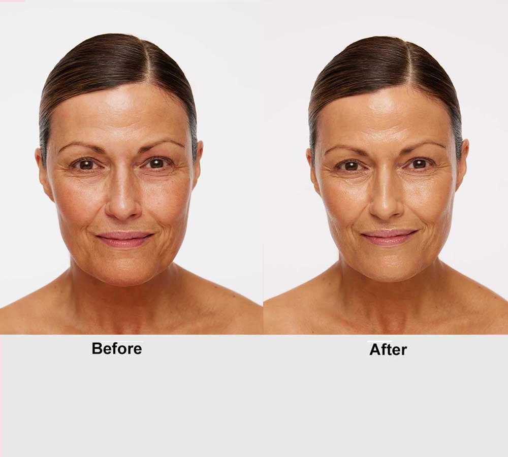 Universal Glow Treatment